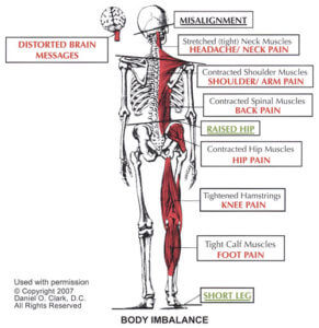 body imbalance